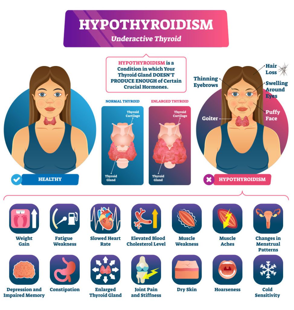 medical marijuana for hypothyroidsim